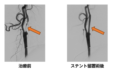 代表症例