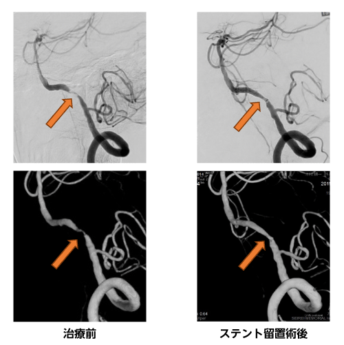 代表症例