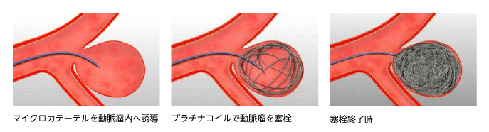 方法