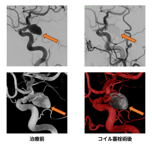 代表症例