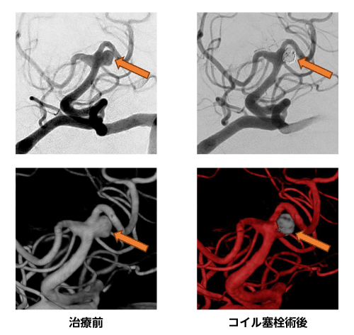 代表症例