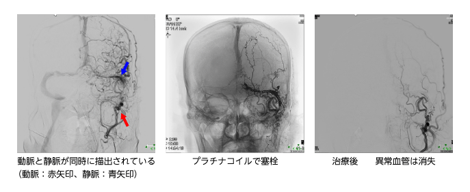 代表症例