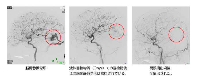 代表症例