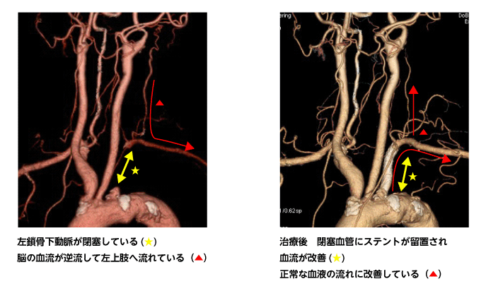 代表症例