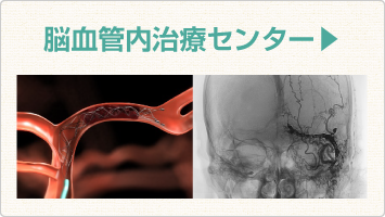 脳血管内治療センター