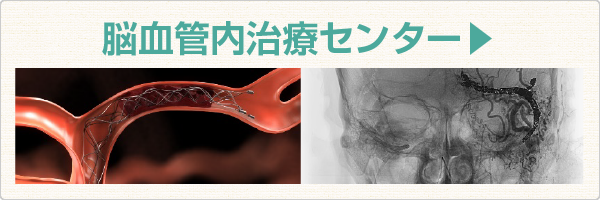 脳血管内治療センター